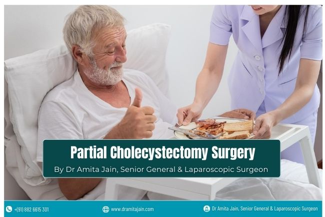 Partial Cholecystectomy Gallbladder Surgeon Delhi Dr Amita Jain Partial Cholecystectomy Gallbladder Surgeon Delhi Dr Amita Jain